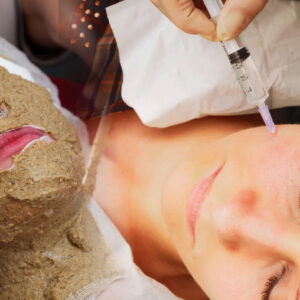 REVITALIZACIÓN FACIAL CON PEELING Y MESOTERAPIA (PROTOCOLOS / COMPLICACIONES) HANDS ON